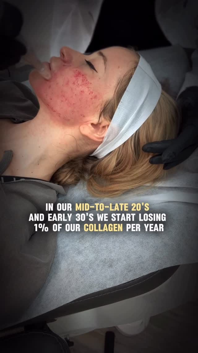 Post 3 by Gaia Mkrtchyan| Nurse Practitioner | Aesthetic Procedures on Instagram (video)