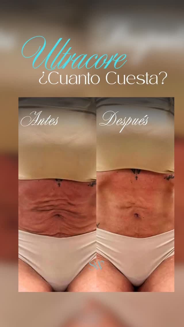 Post 1 by Slim World on Instagram (video)