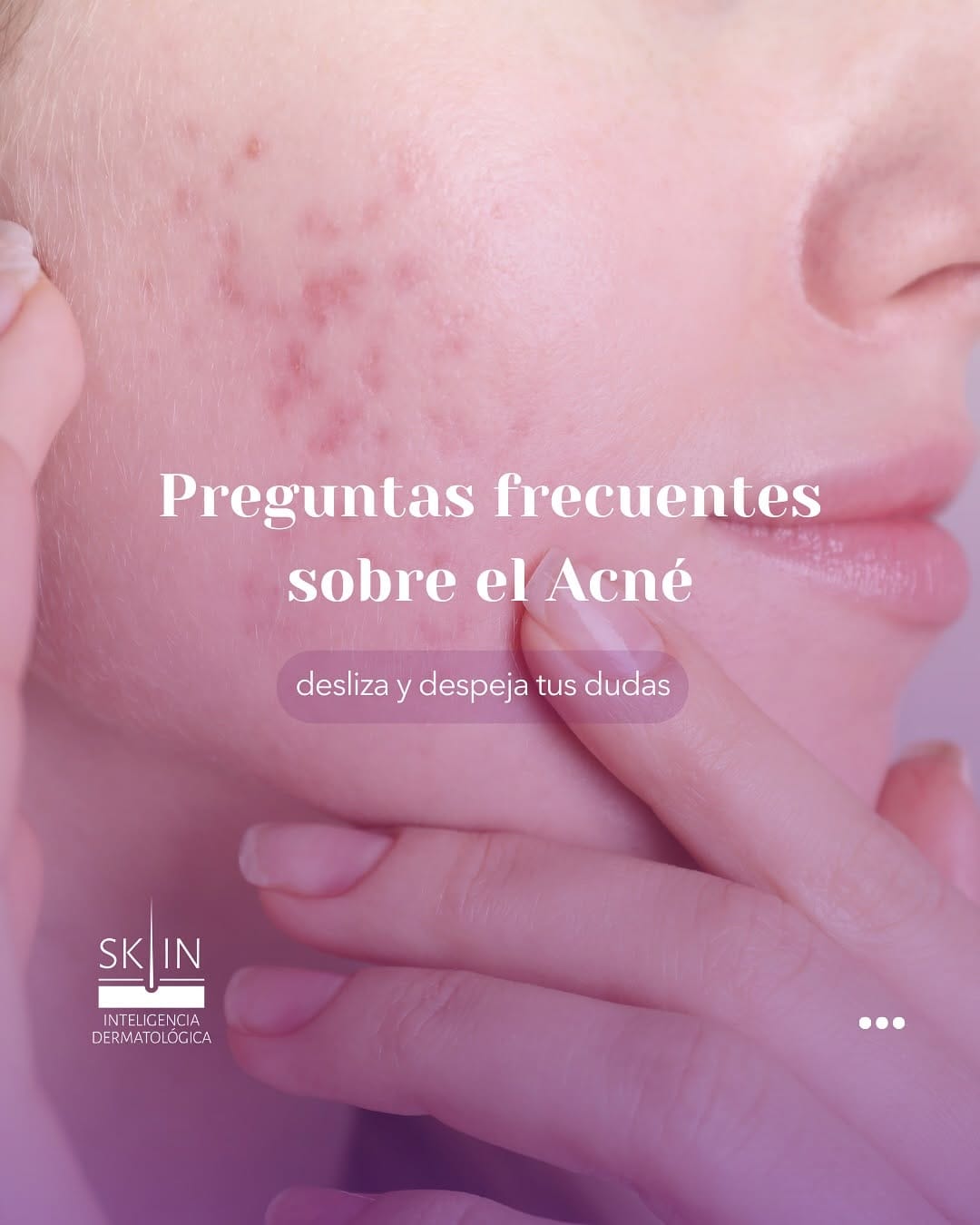 Post 2 by SK•INteligencia Dermatológica on Instagram (carousel)