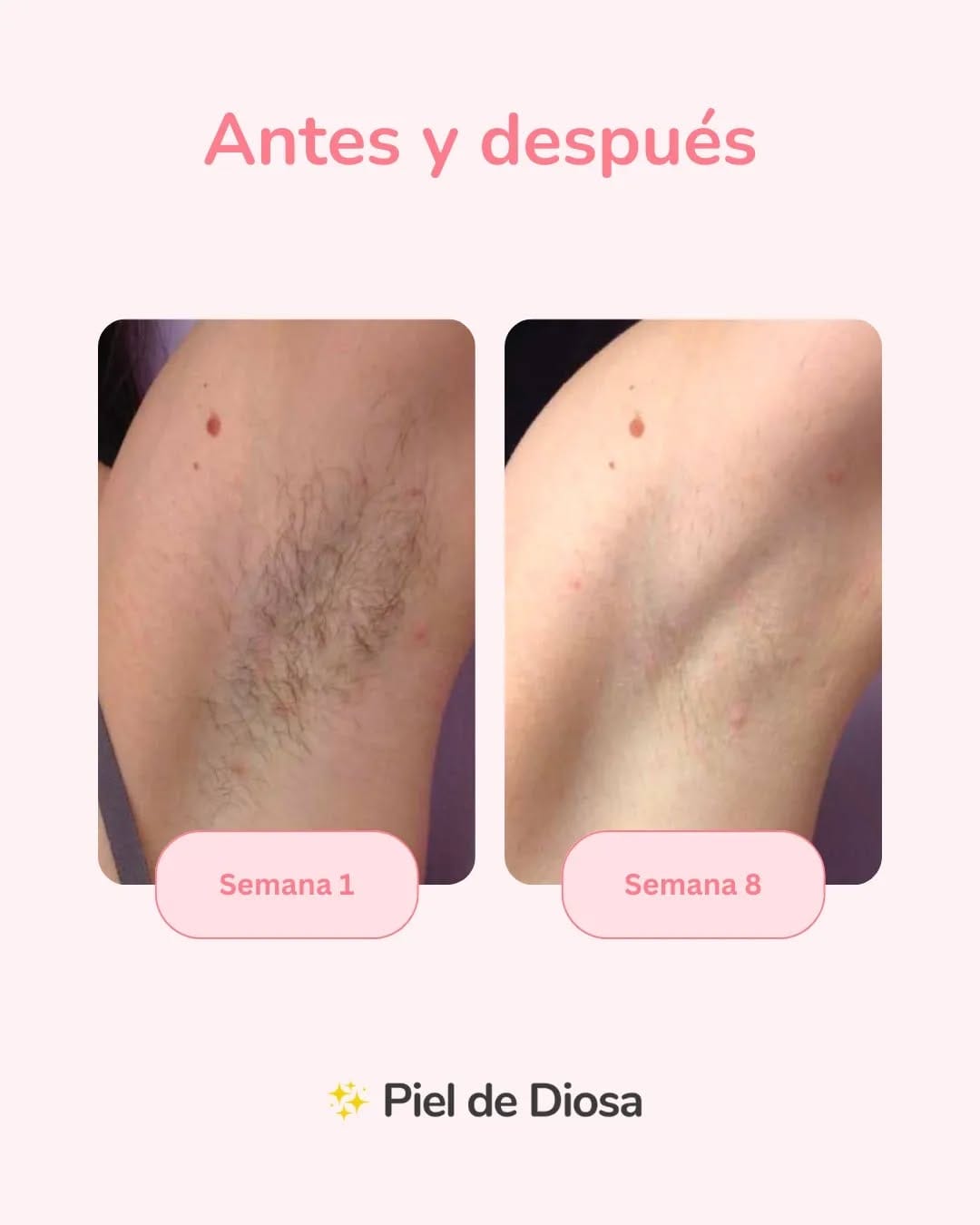 Post 2 by Piel de Diosa on Instagram (image)