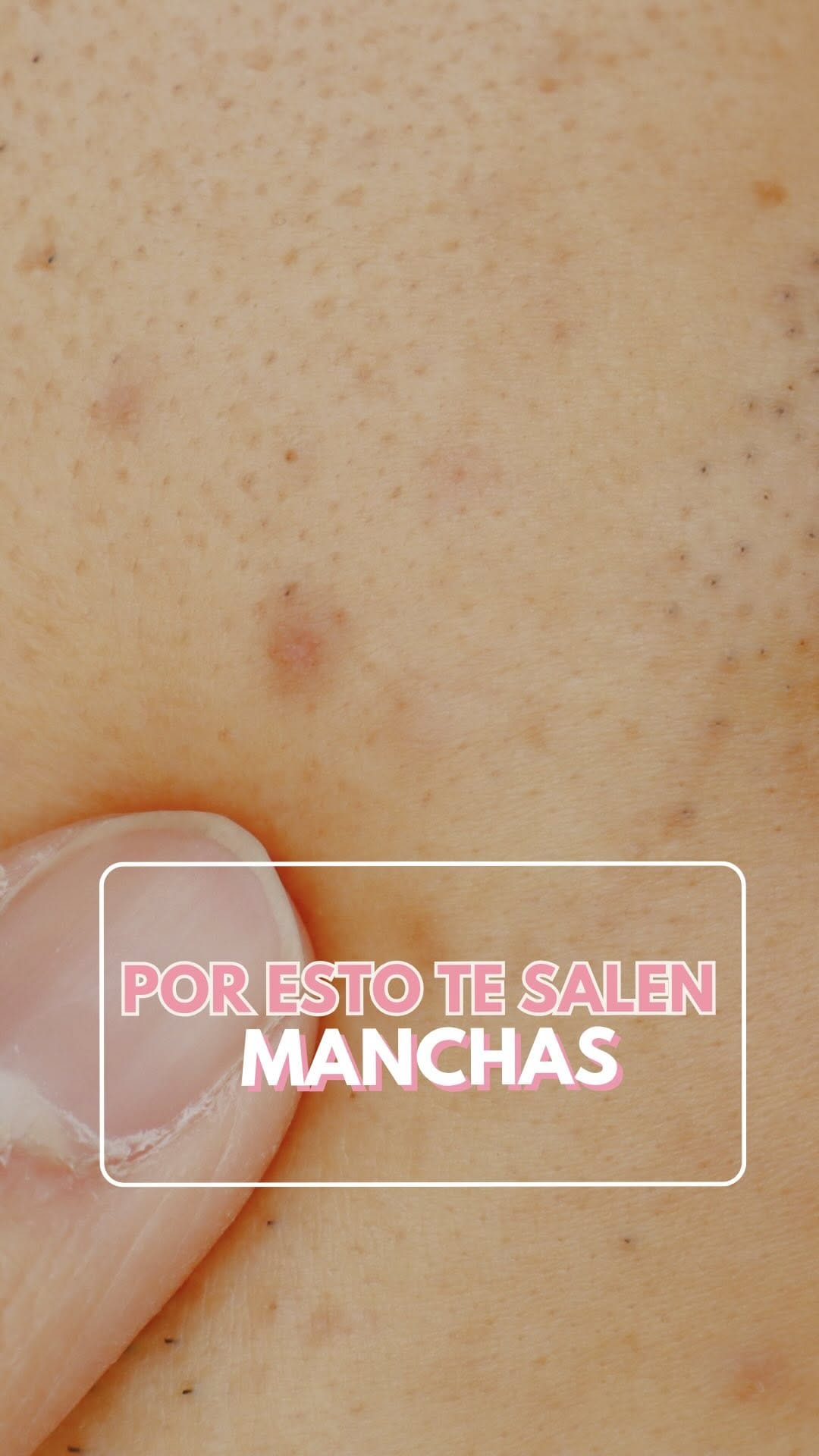 Post 4 by Dra. Guadalupe Bueno | Dermatóloga on Instagram (video)