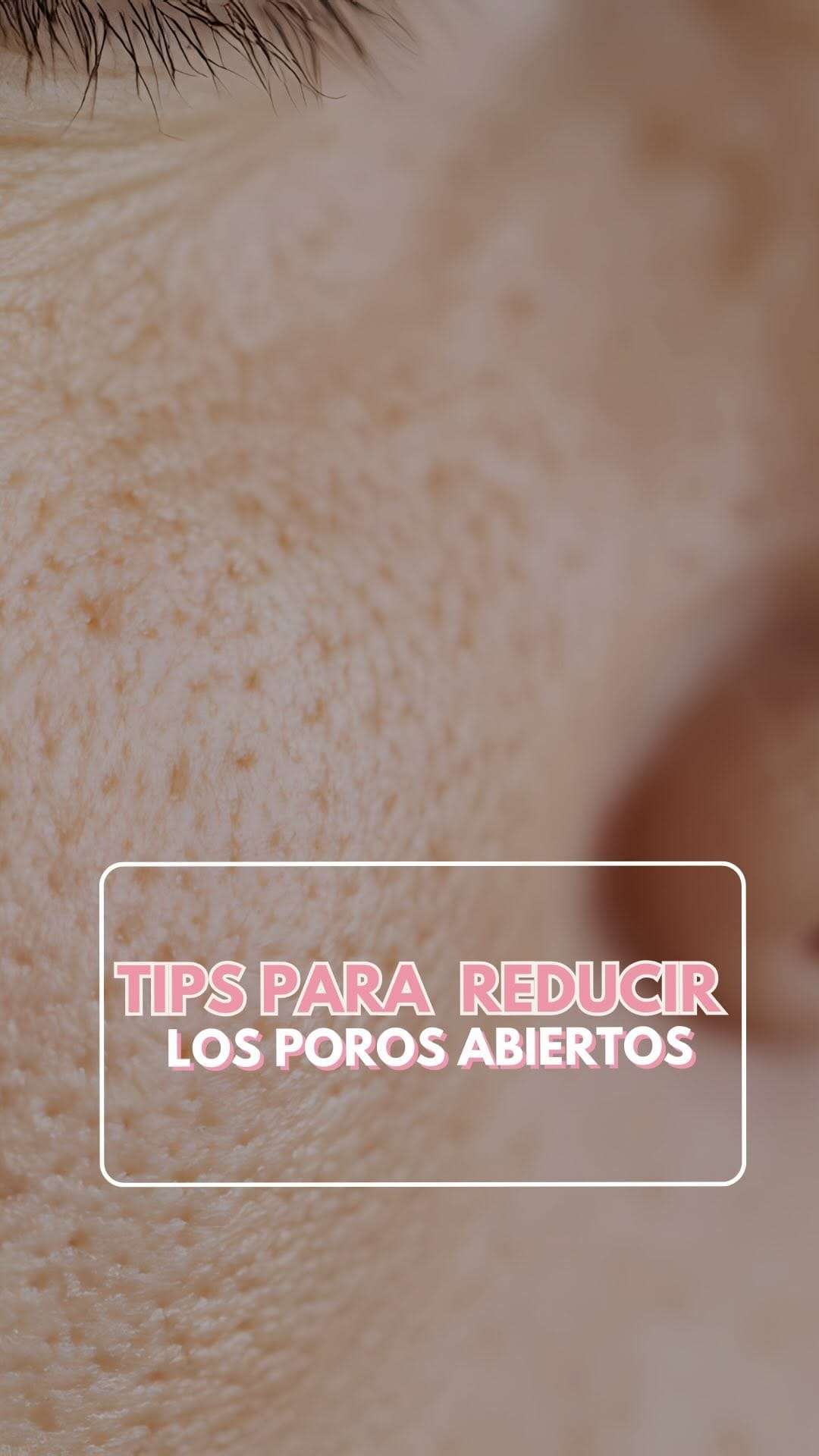 Post 8 by Dra. Guadalupe Bueno | Dermatóloga on Instagram (video)