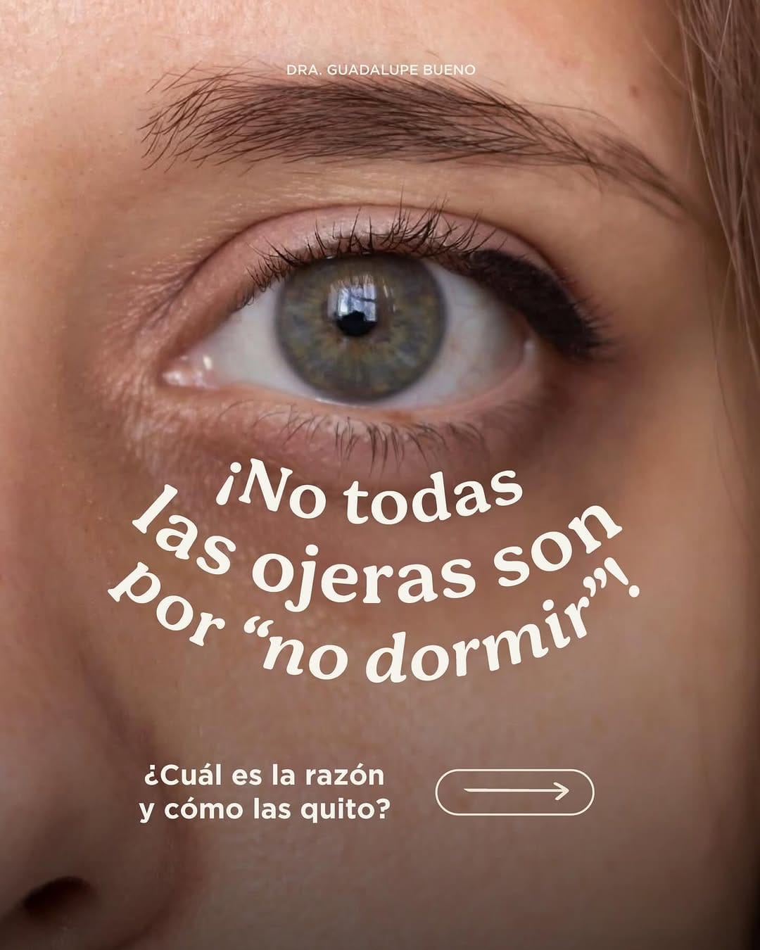 Post 9 by Dra. Guadalupe Bueno | Dermatóloga on Instagram (carousel)