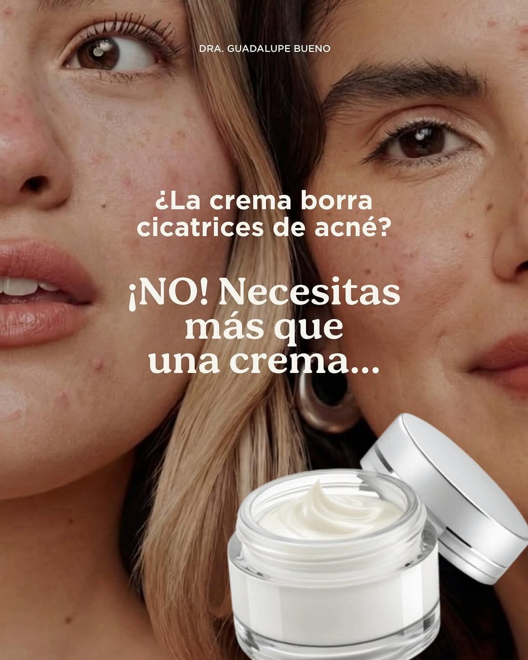 Post 1 by Dra. Guadalupe Bueno | Dermatóloga on Instagram (carousel)