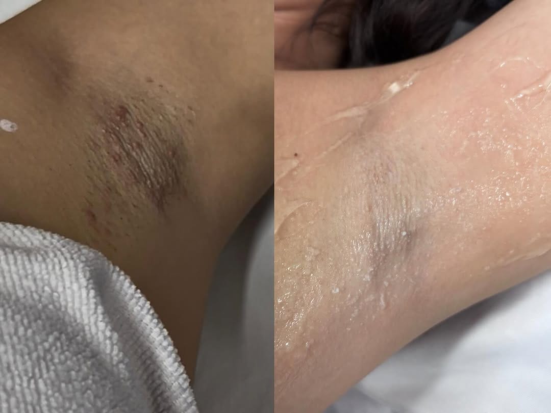 Post 5 by Reset Functional Skin on Instagram (image)