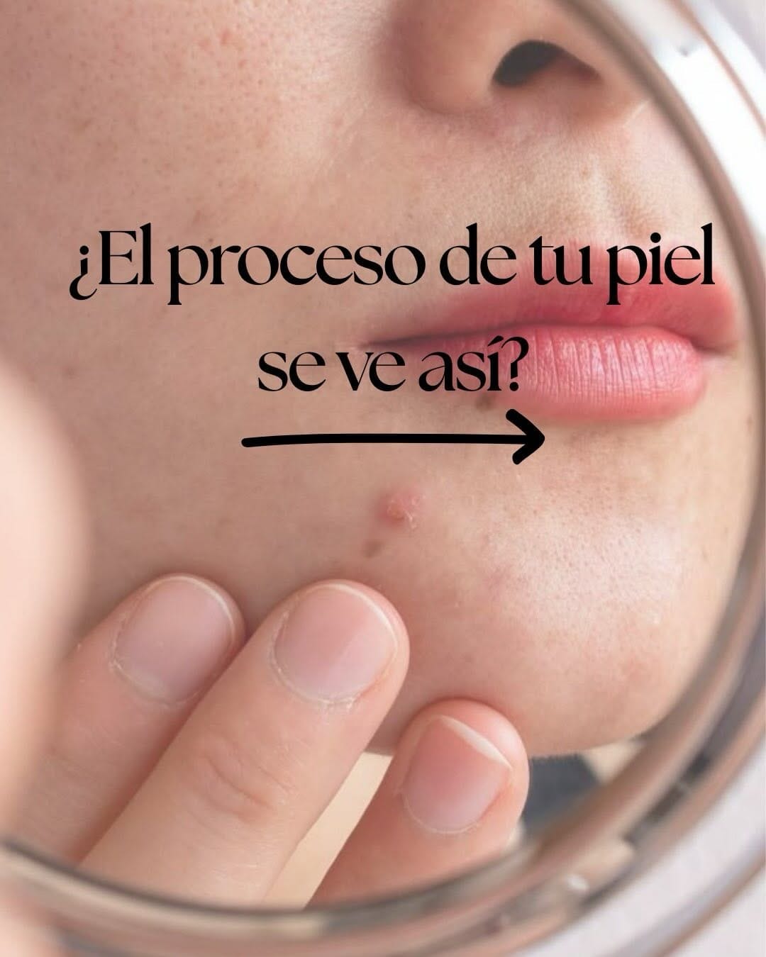 Post 2 by Reset Functional Skin on Instagram (carousel)