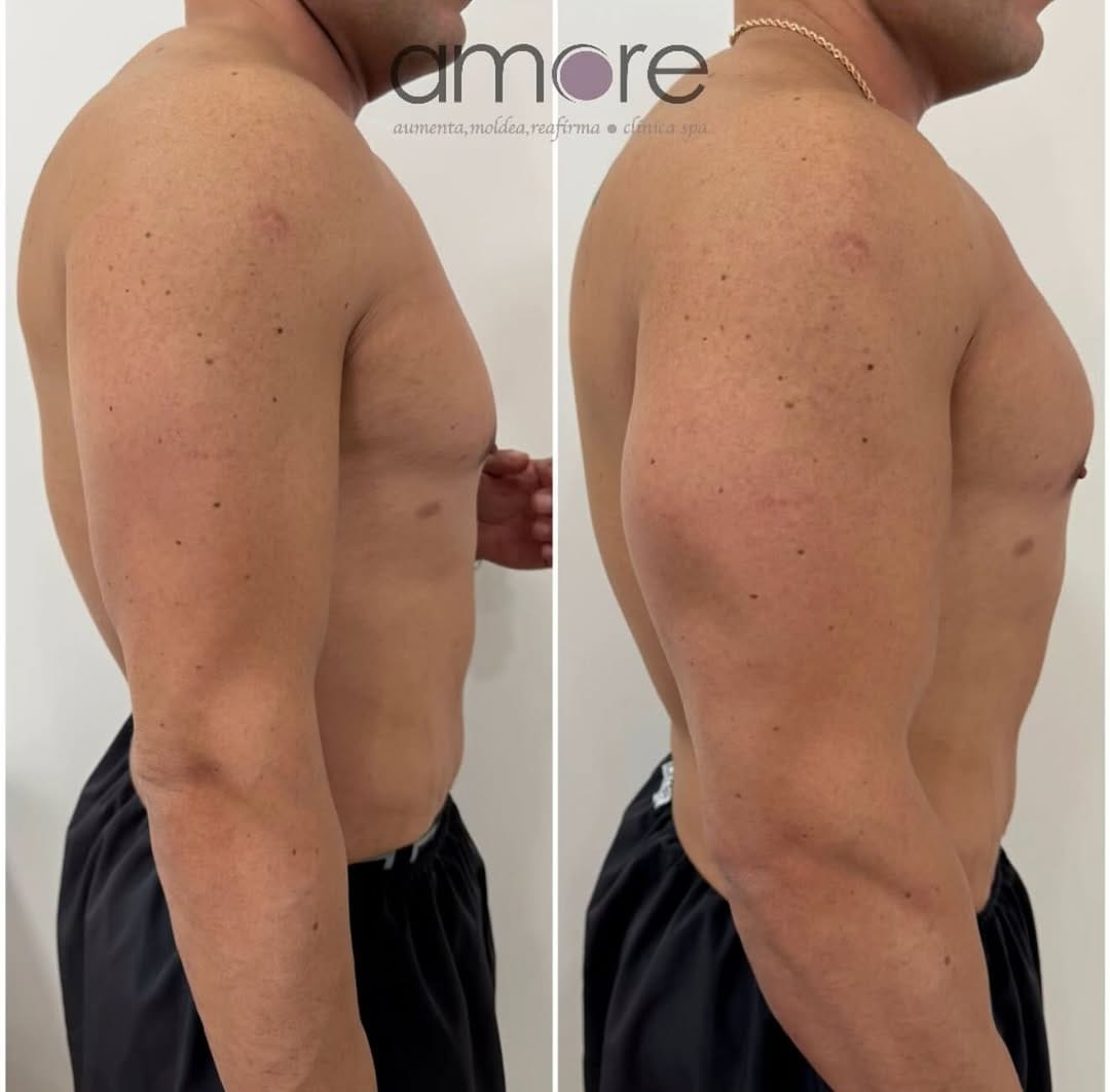 Post 2 by Amore Clinica y Spa on Instagram (image)