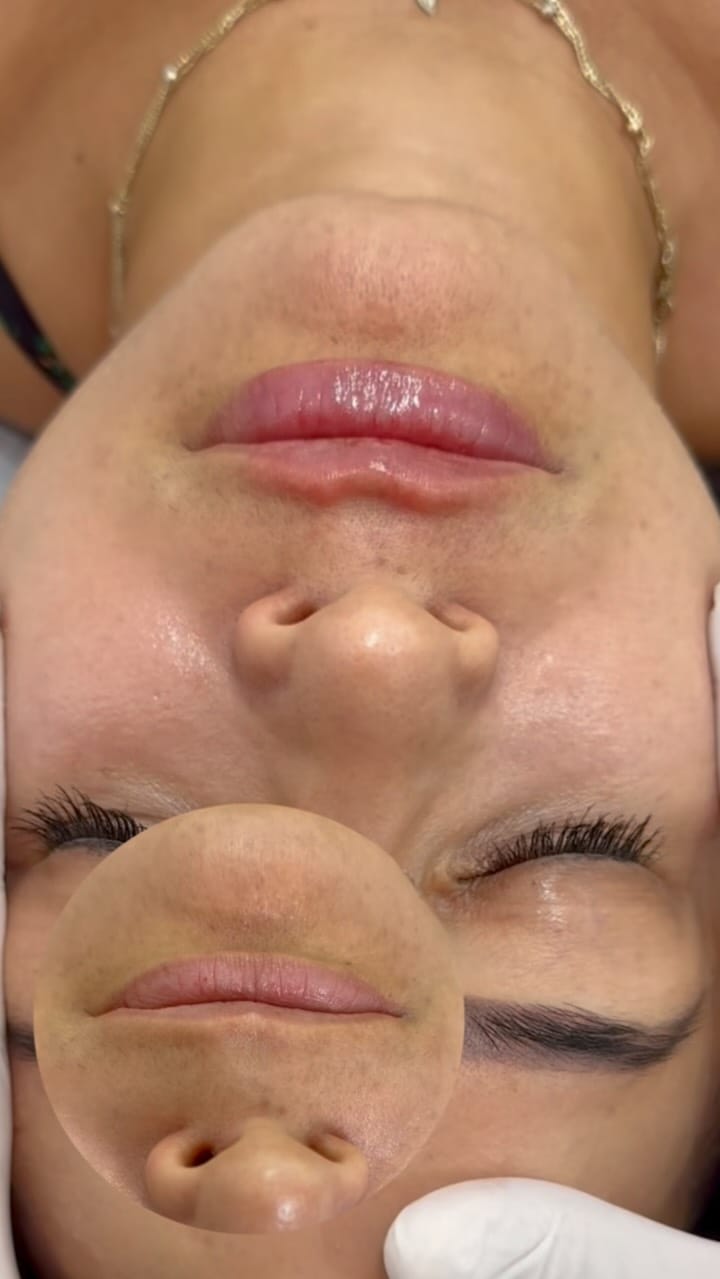 Post 5 by Amore Clinica y Spa on Instagram (video)