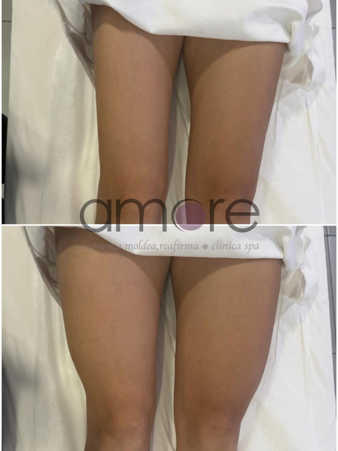 Post 6 by Amore Clinica y Spa on Instagram (image)