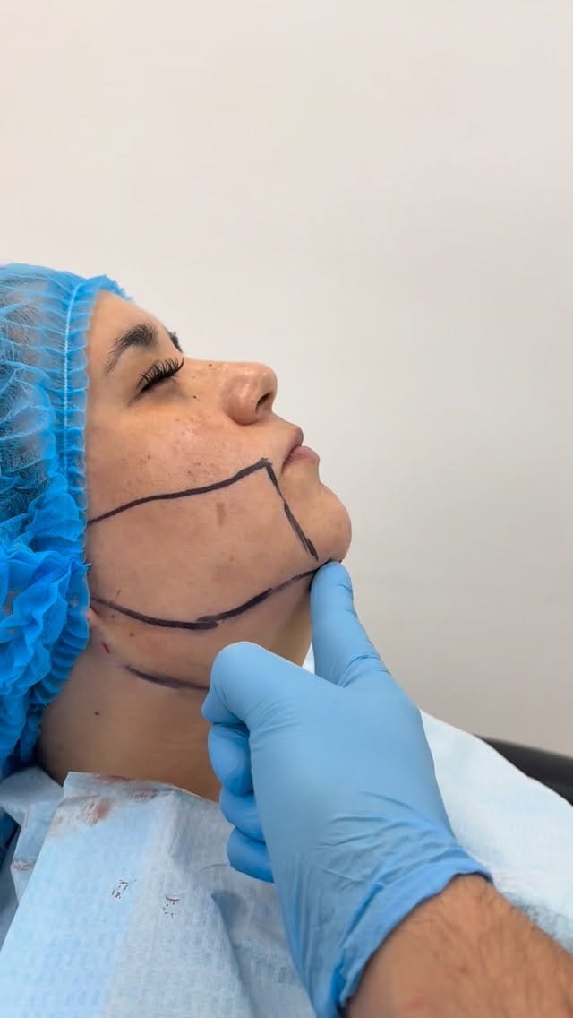 Post 3 by Dr. Farid Samaha on Instagram (video)