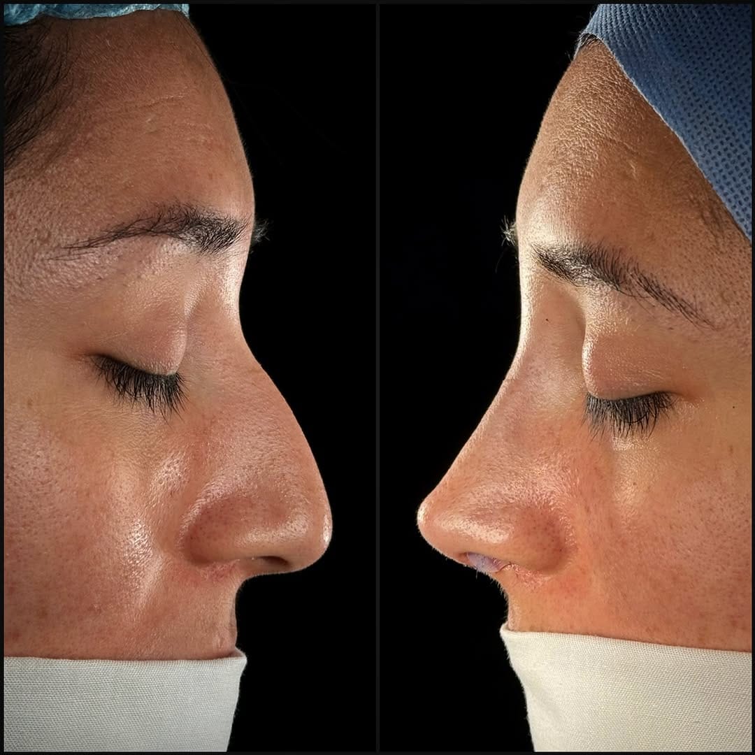 Post 3 by Dr. Luis H. Olavarrieta on Instagram (carousel)