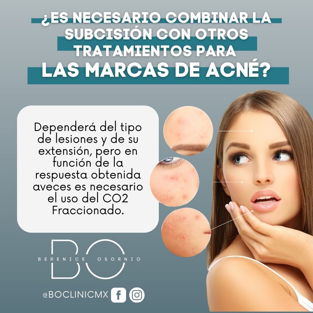 Post 10 by BO SPA Médico on Instagram (image)