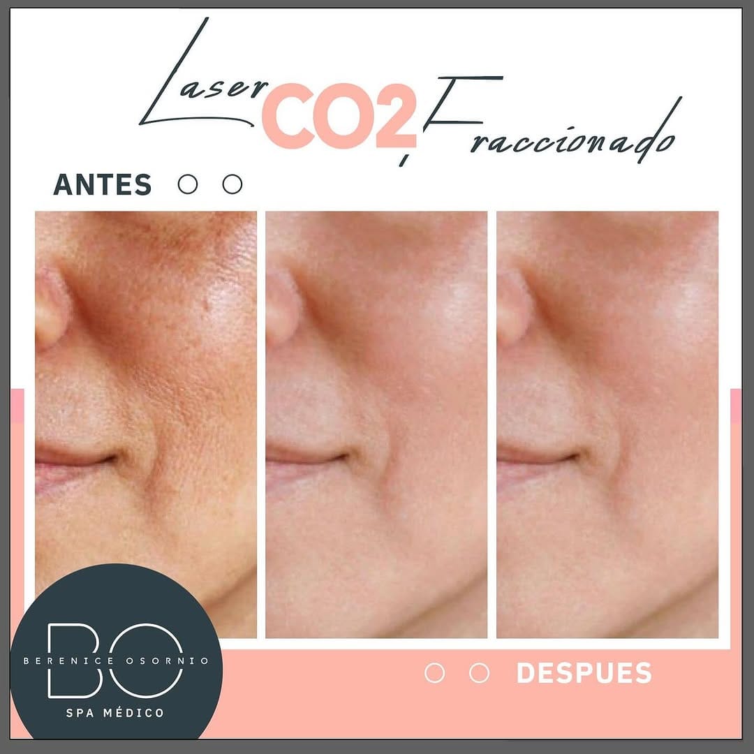 Post 7 by BO SPA Médico on Instagram (image)
