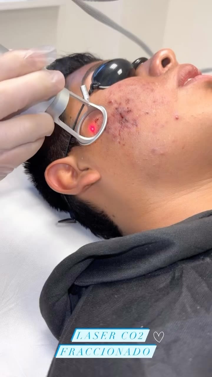 Post 6 by BO SPA Médico on Instagram (video)