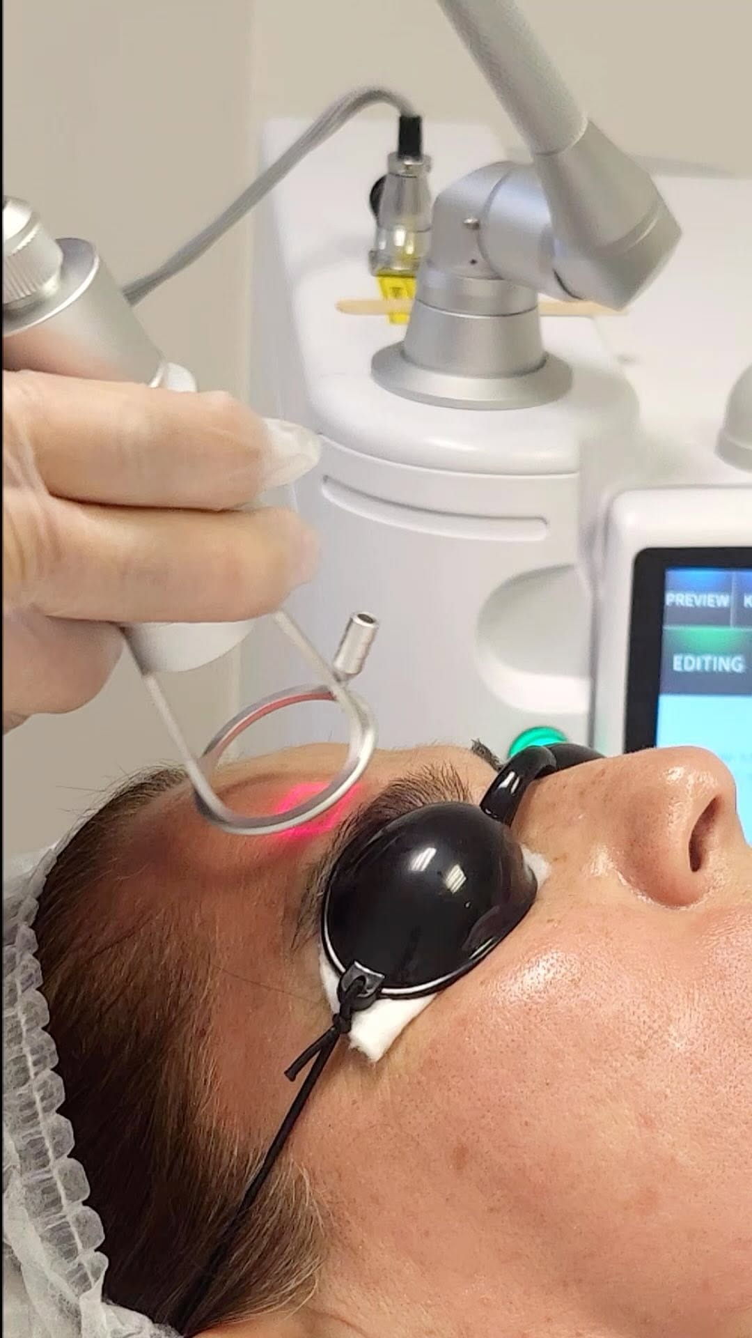 Post 5 by BO SPA Médico on Instagram (video)