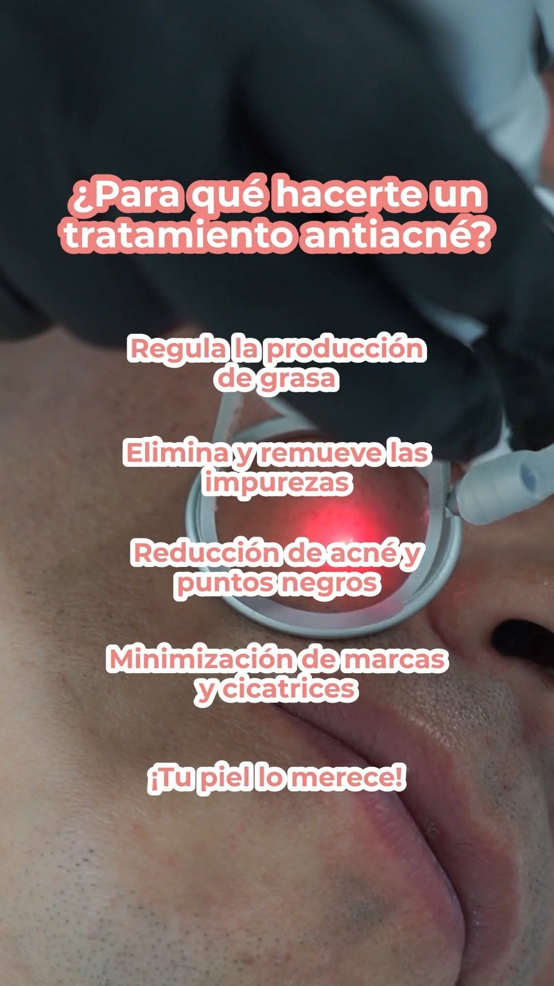 Post 1 by BO SPA Médico on Instagram (video)