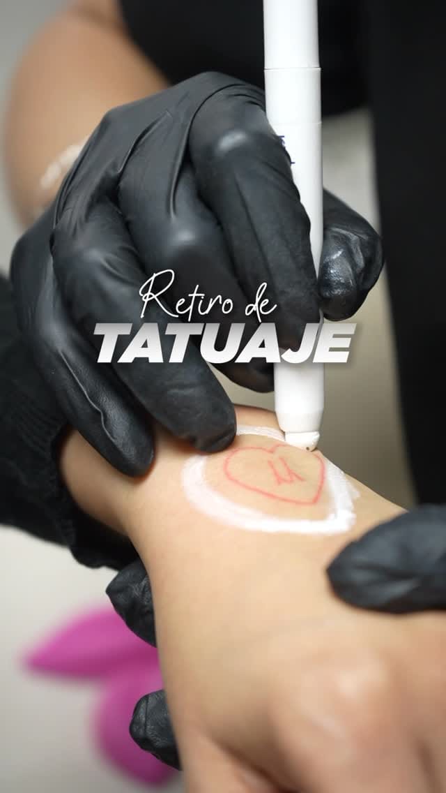 Post 5 by Own Skin | Medicina Estética | Dermatología on Instagram (video)