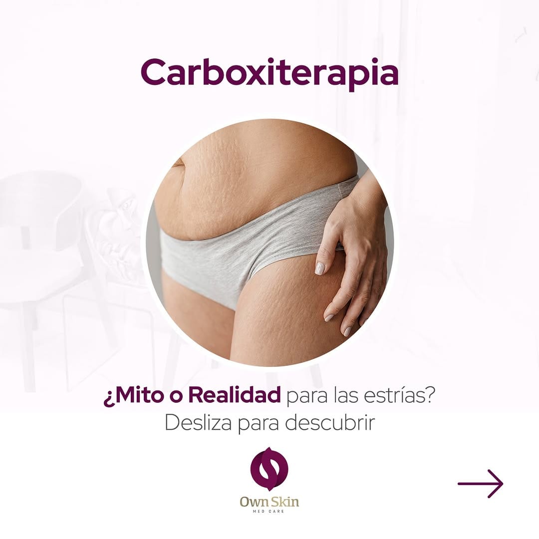 Post 2 by Own Skin | Medicina Estética | Dermatología on Instagram (carousel)