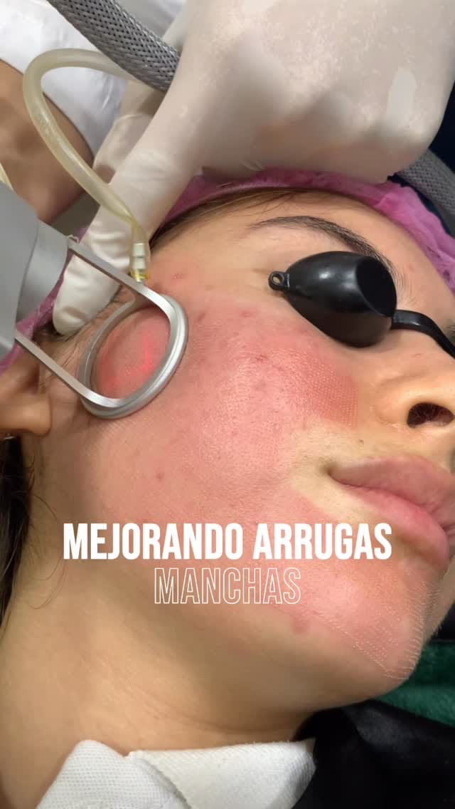 Post 3 by Derma Latina on Instagram (video)