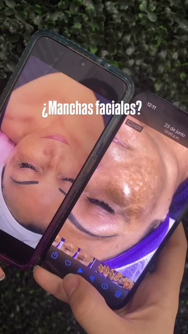 Post 7 by Derma Latina on Instagram (video)