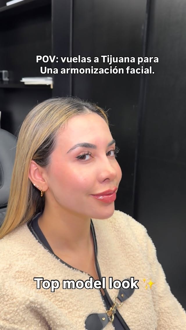 Post 2 by Rafael Valencia, M.D. Aesthetic Medicine on Instagram (video)