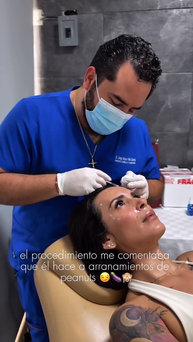 Post 8 by Dr. Jorge Ávila Colonia | Rinomodelación | Labios | Hilos on Instagram (video)