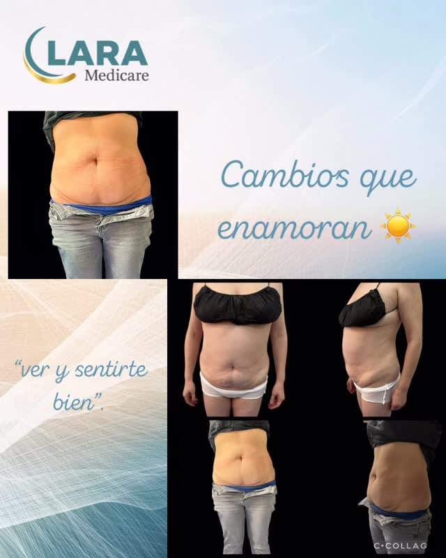 Post 10 by Estética Facial | Corporal y Oftalmología on Instagram (video)