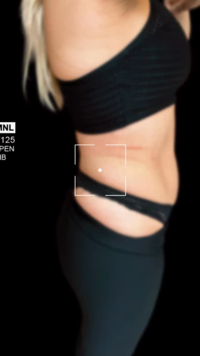 Post 3 by Estética Facial | Corporal y Oftalmología on Instagram (video)