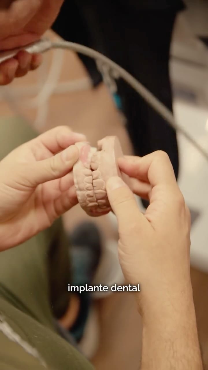 Post 8 by GLOSS DENT MÉXICO ® Carillas Dentales on Instagram (video)