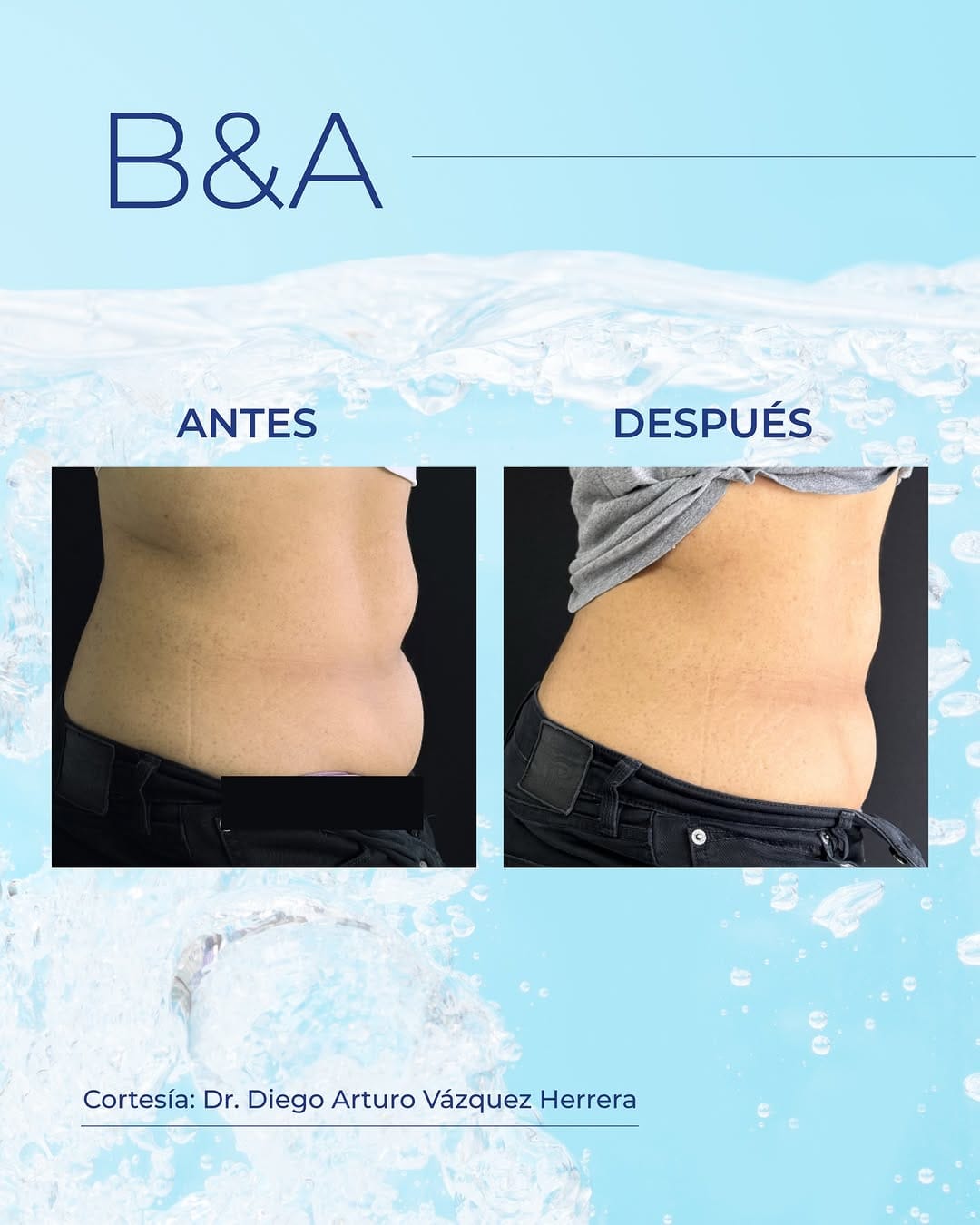 Post 5 by Dermavan México on Instagram (carousel)