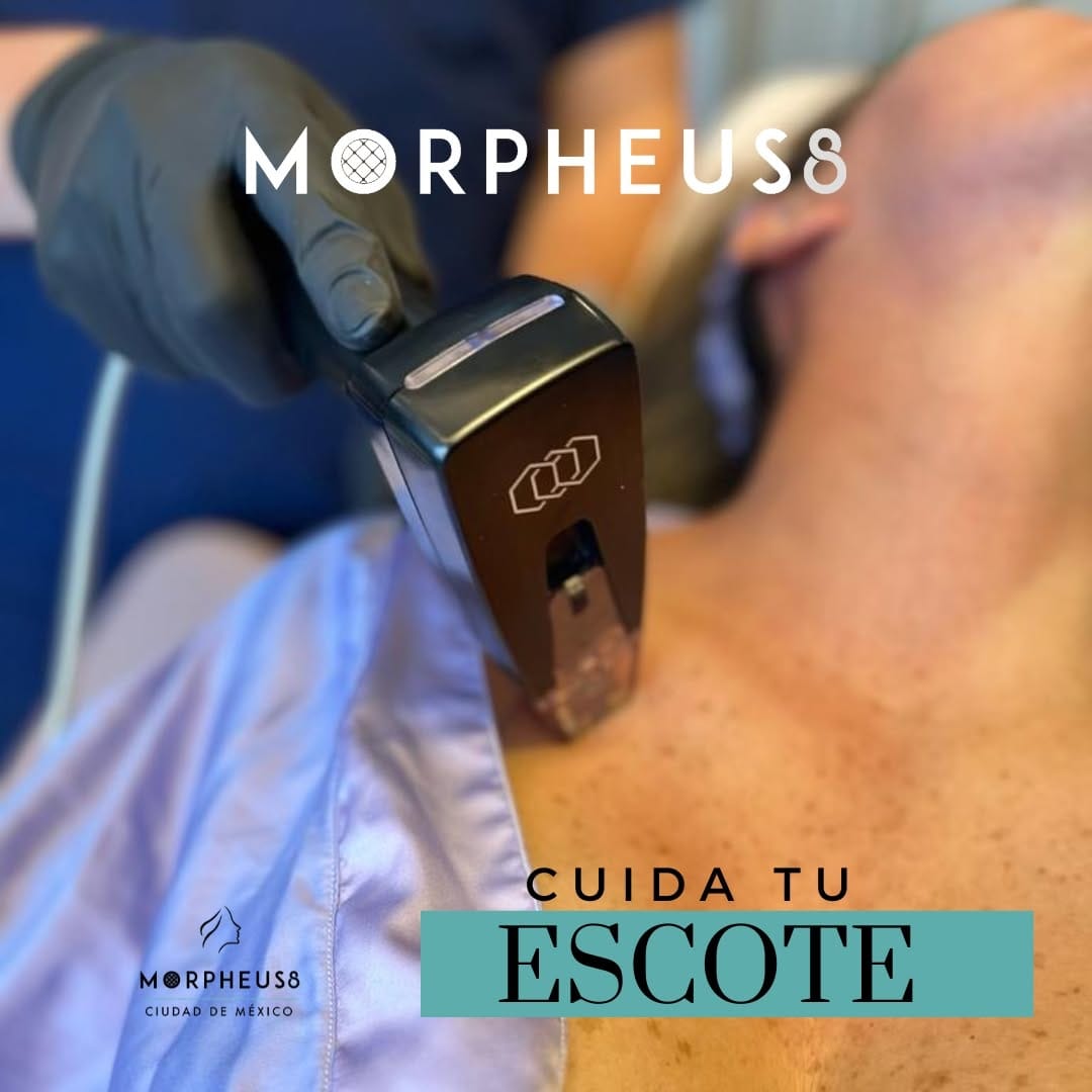 Post 10 by Morpheus8 Pro Cdmx on Instagram (image)
