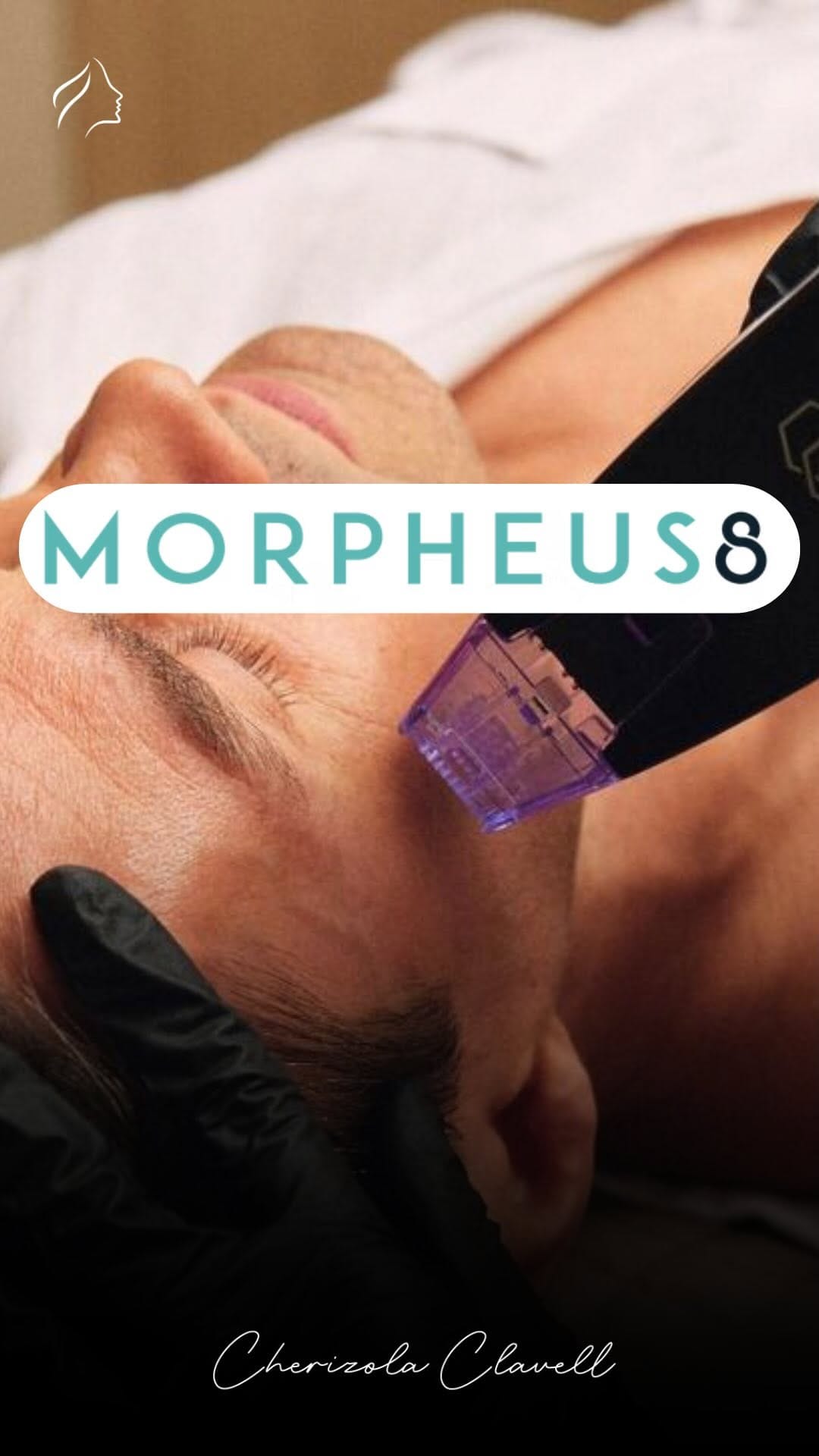 Post 1 by Morpheus8 Pro Cdmx on Instagram (video)