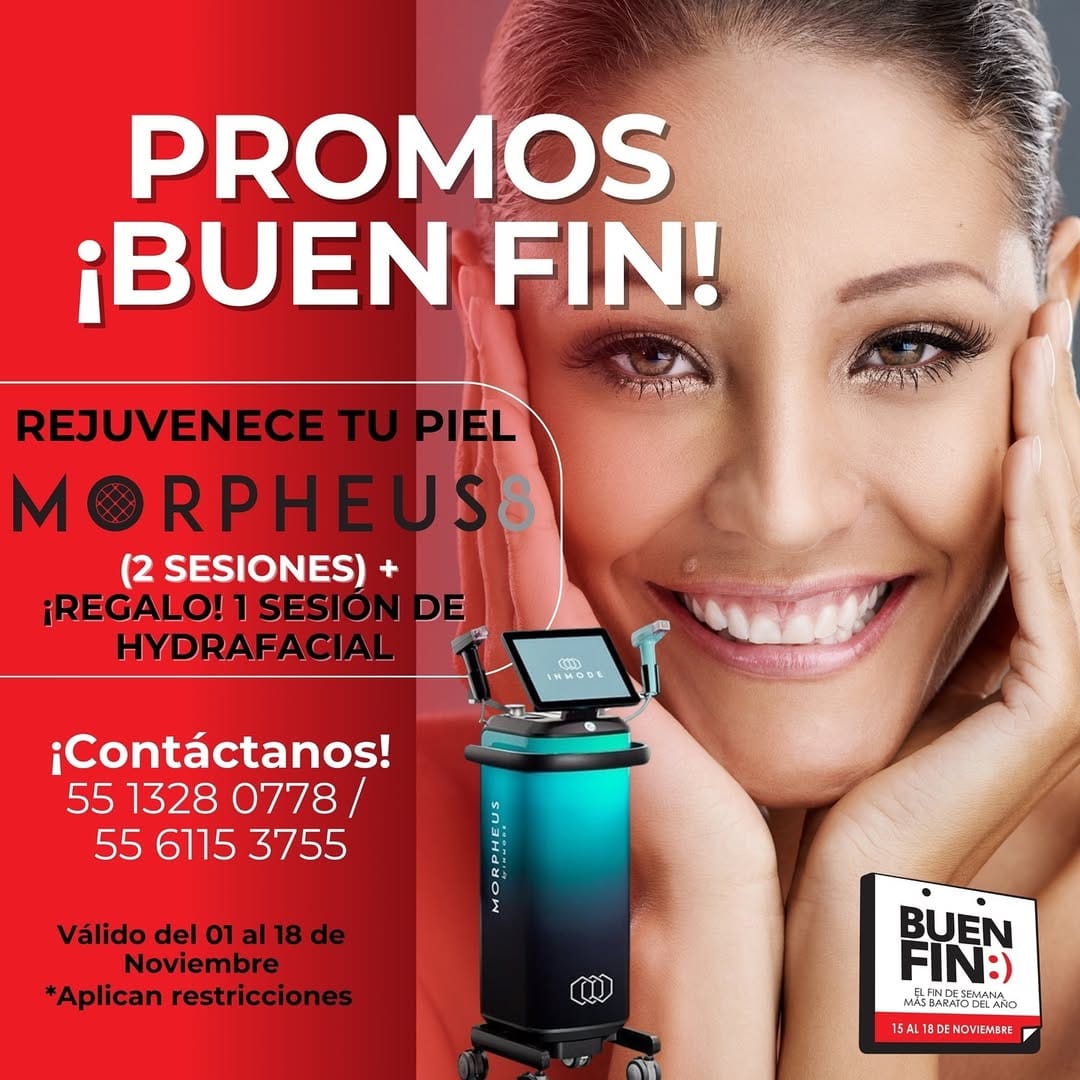 Post 2 by Morpheus8 Pro Cdmx on Instagram (image)