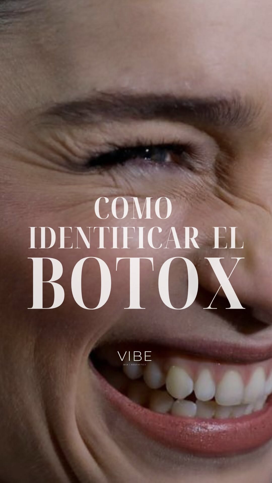 Post 10 by VIBE BSA|AESTHETICS on Instagram (video)