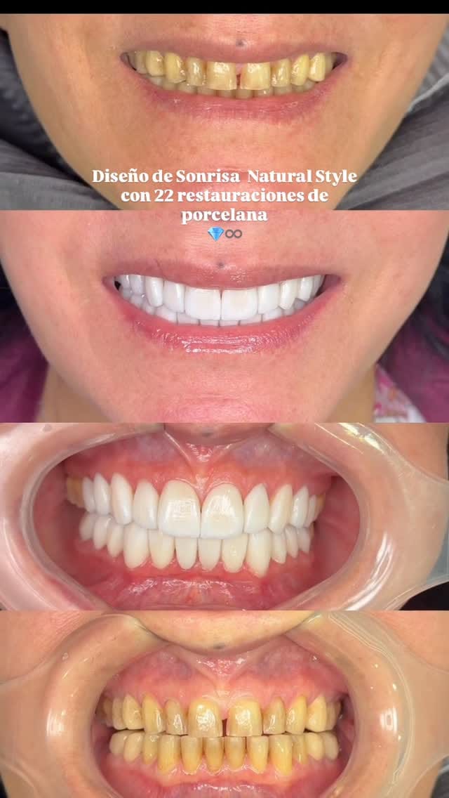 Post 3 by PRODENT AESTHETIC CLINIC on Instagram (video)