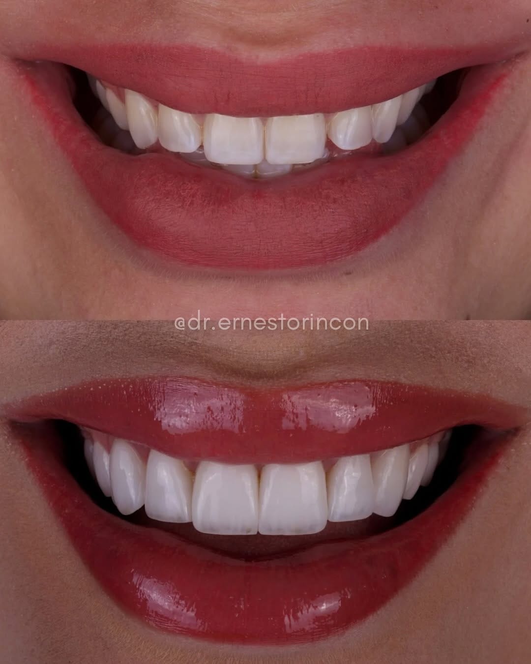 Post 6 by Dr. Ernesto Rincón on Instagram (carousel)