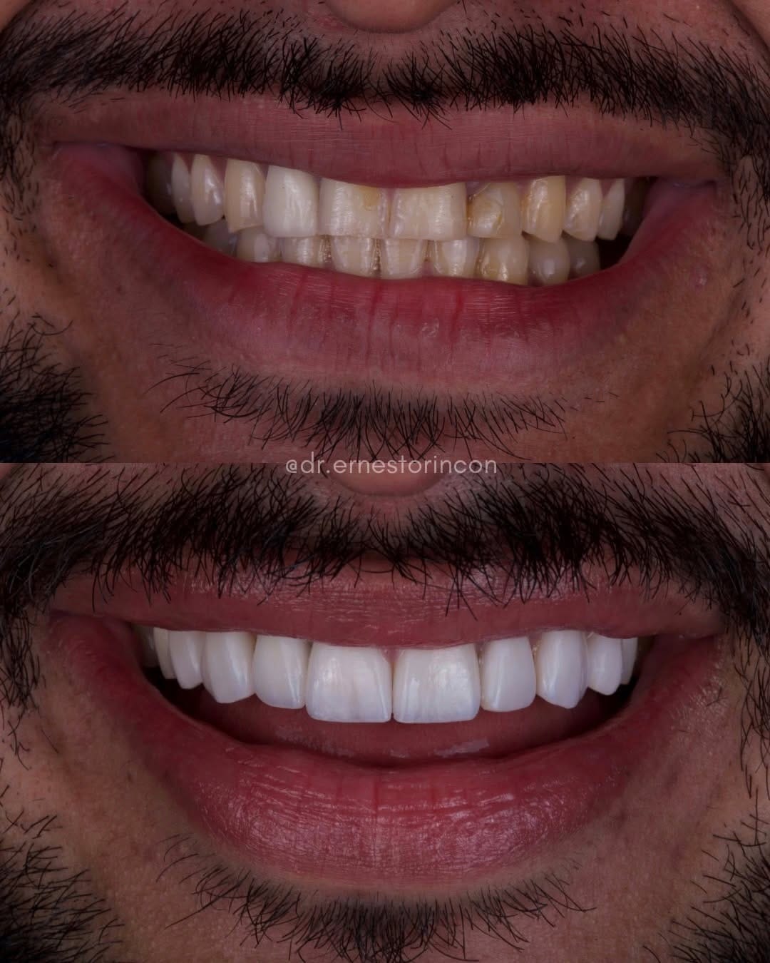 Post 3 by Dr. Ernesto Rincón on Instagram (carousel)