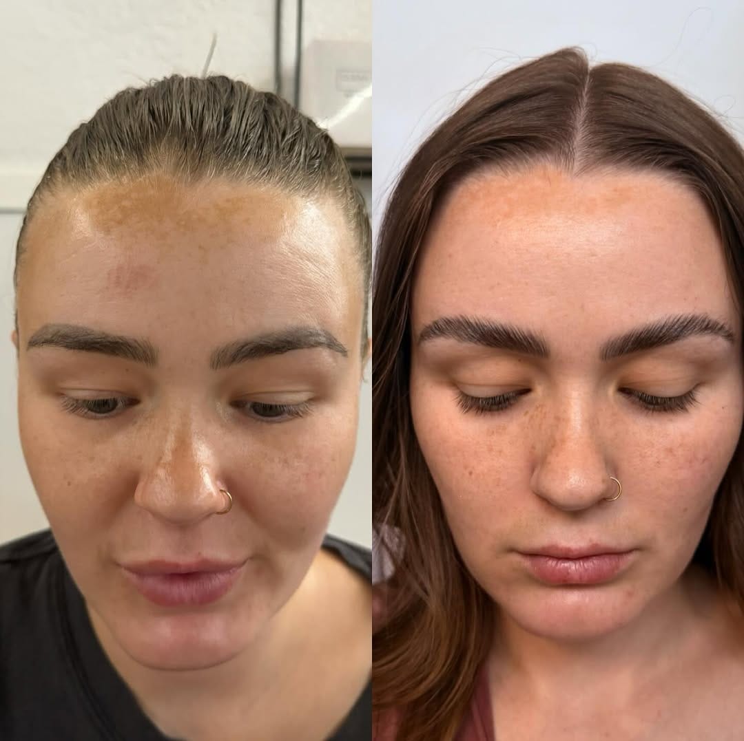 Post 8 by 𝚈𝙾𝚄𝚁 𝚂𝙺𝙸𝙽 𝙲𝙰𝚁𝙴 𝙳𝙴𝙰𝙻𝙴𝚁 on Instagram (carousel)
