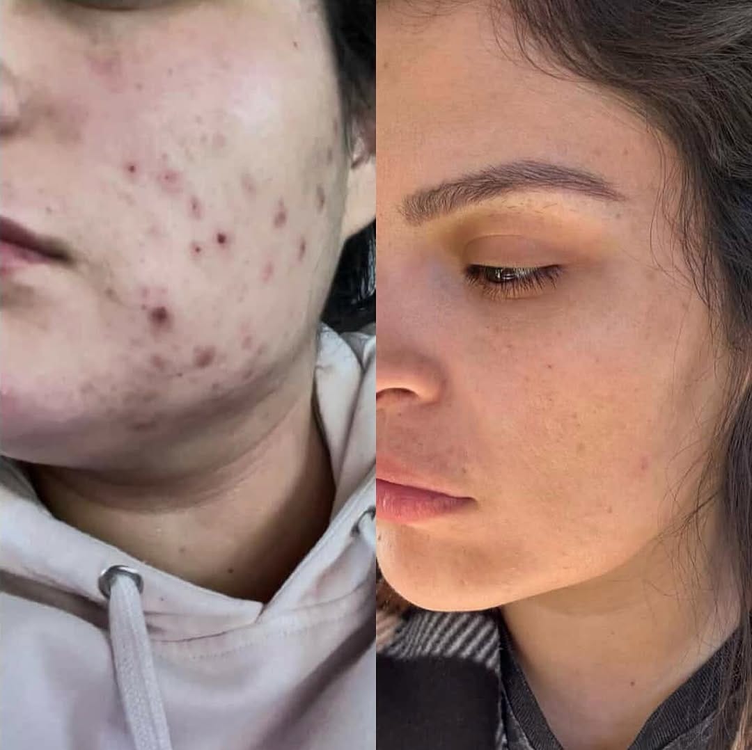 Post 9 by 𝚈𝙾𝚄𝚁 𝚂𝙺𝙸𝙽 𝙲𝙰𝚁𝙴 𝙳𝙴𝙰𝙻𝙴𝚁 on Instagram (image)