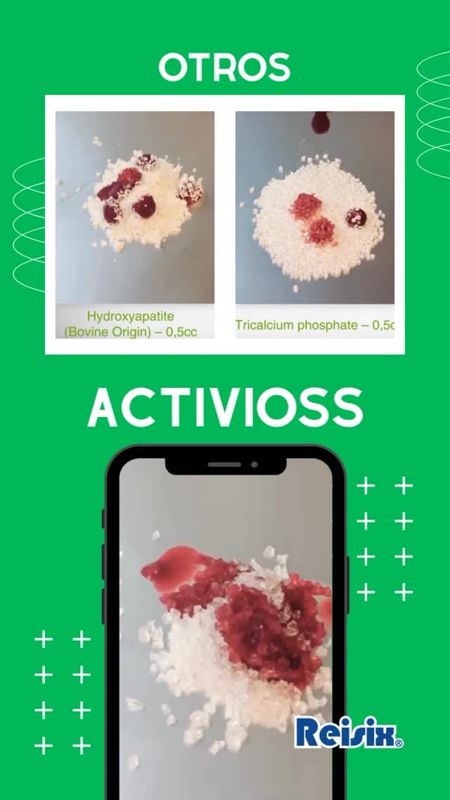 Post 5 by Deposito Dental REISIX on Instagram (video)