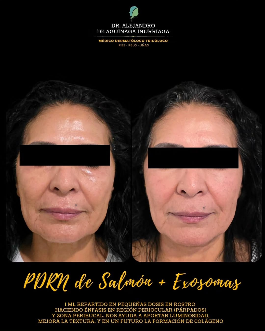 Post 2 by ᴅʀ. ᴀʟᴇᴊᴀɴᴅʀᴏ ᴅᴇ ᴀɢᴜɪɴᴀɢᴀ -
ᴅᴇʀᴍᴀᴛᴏʟᴏɢᴏ ᴛʀɪᴄᴏʟᴏɢᴏ on Instagram (image)