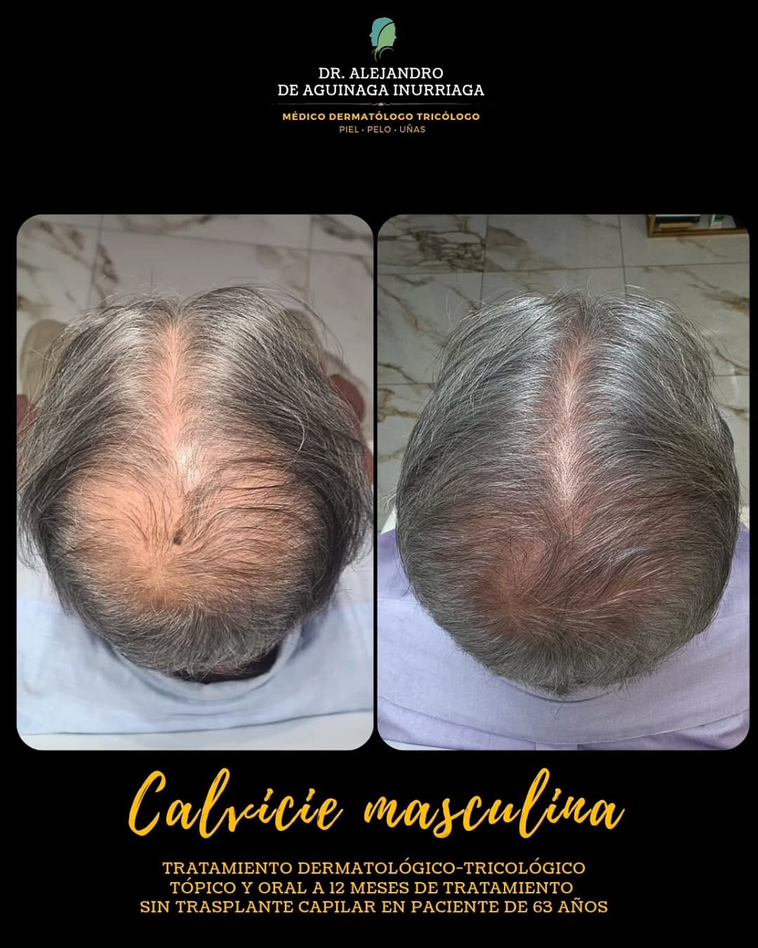 Post 5 by ᴅʀ. ᴀʟᴇᴊᴀɴᴅʀᴏ ᴅᴇ ᴀɢᴜɪɴᴀɢᴀ -
ᴅᴇʀᴍᴀᴛᴏʟᴏɢᴏ ᴛʀɪᴄᴏʟᴏɢᴏ on Instagram (image)