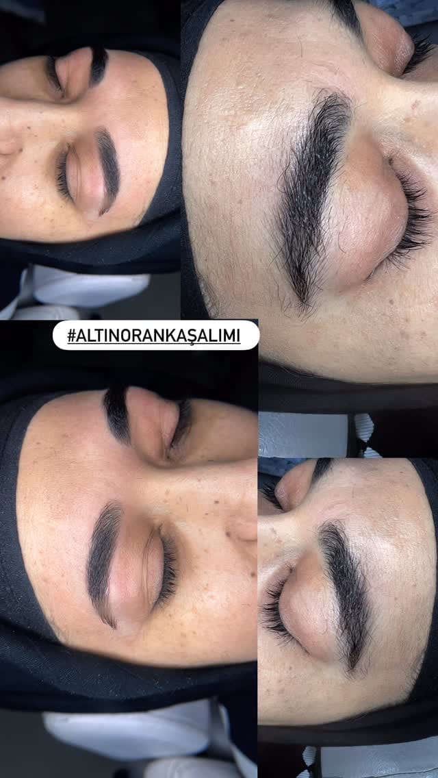 Post 5 by Uzm.Estetisyen USTA ÖĞRETİCİ on Instagram (video)