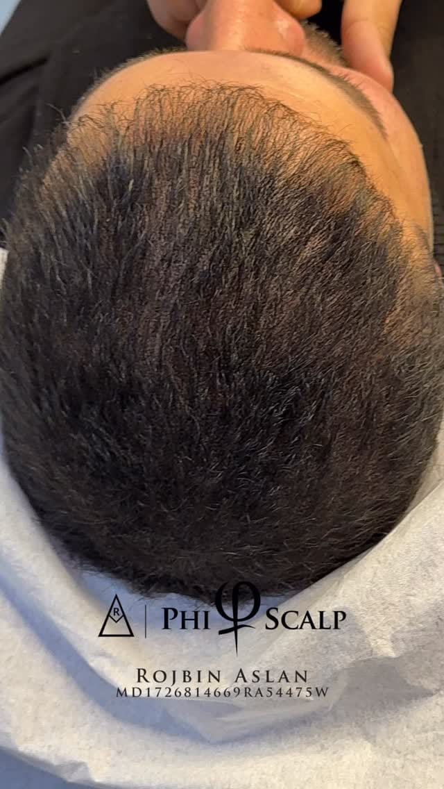 Post 3 by Rojbin Aslan on Instagram (video)