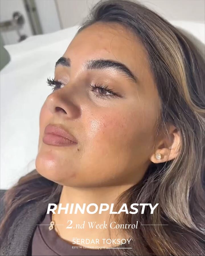 Post 2 by Op.Dr.Serdar Toksoy on Instagram (carousel)