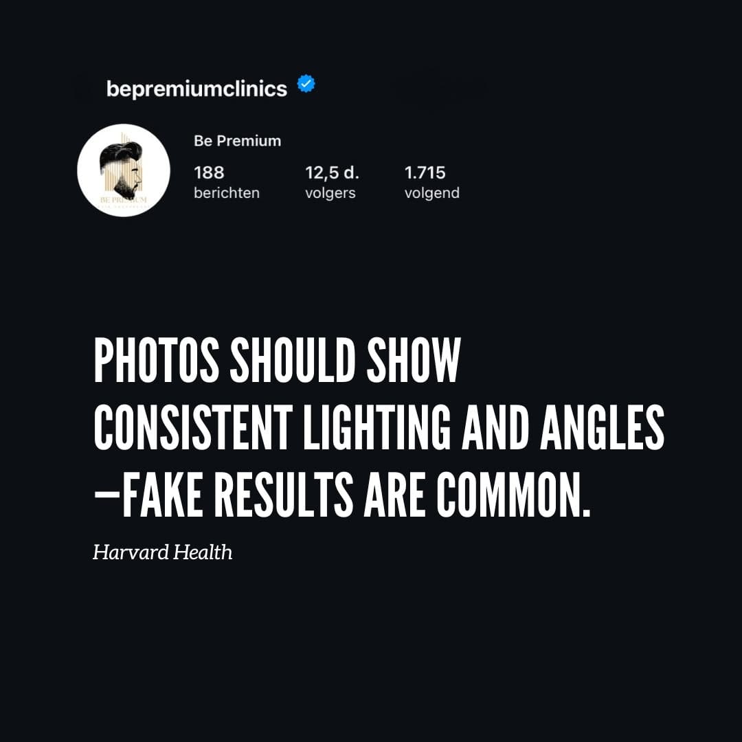 Post 9 by Be Premium on Instagram (image)