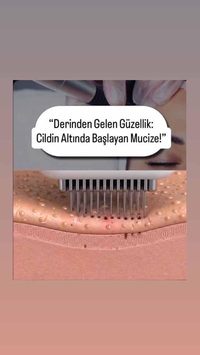 Post 9 by D'House Güzellik Merkezi by DİLBER YENİ on Instagram (video)