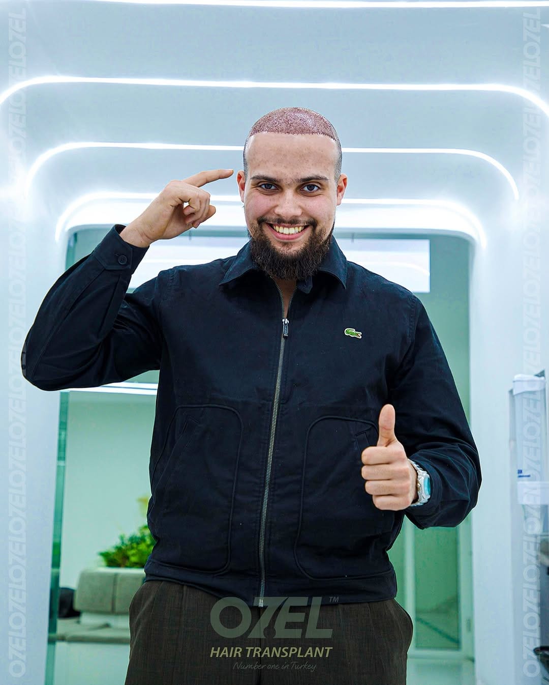 Post 9 by Ozel Hair Transplant on Instagram (image)