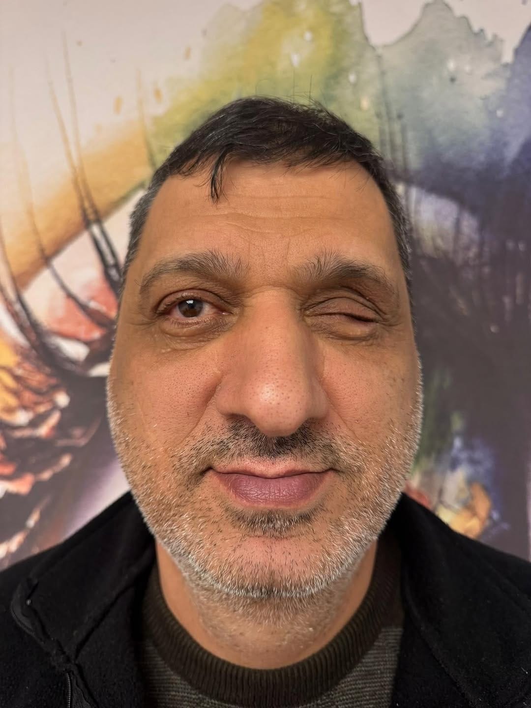 Post 3 by Renk Protez Göz Merkezi on Instagram (carousel)
