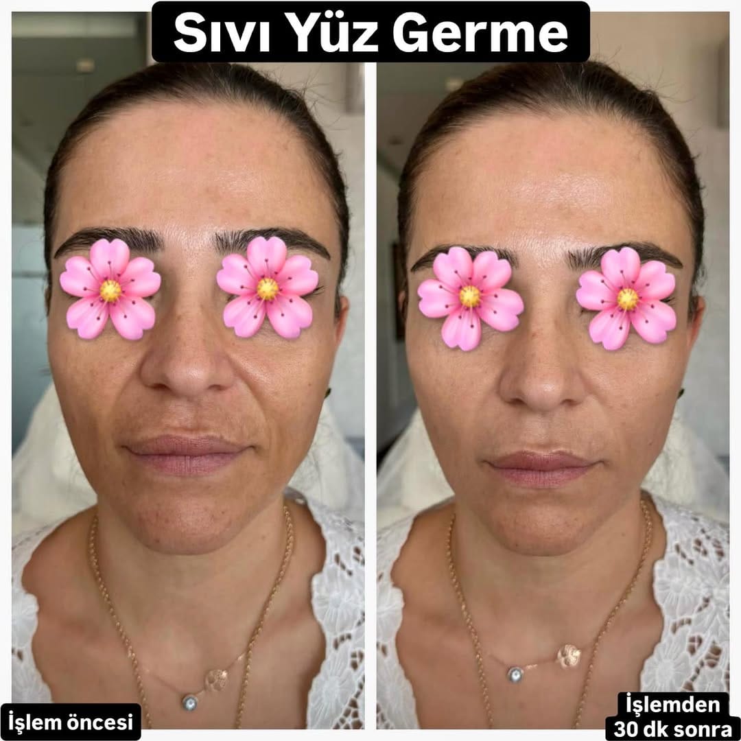 Post 4 by Uzm.Dr.Sabri Güncan on Instagram (image)